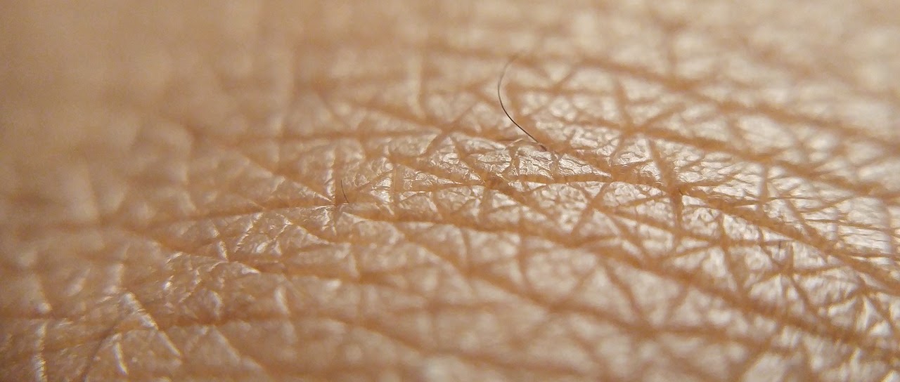 Monkeypox: A Monkey’s Perspective archival image 1